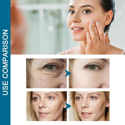 EELHOE 30ml Collagen Boost Aging Serum Firming Skin Fade Fine Lines Wrinkles Dark Spots Correcting Nourishing Essence Skin Care