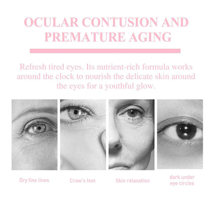 Retinol Eye Cream Stick Fade Fine Line Remove Wrinkle Eye Bags Anti-Puffiness Dark Circle Smoothing Firming Under Eye Skin Care