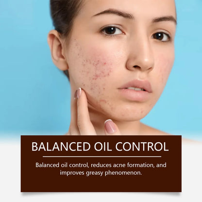 Pore Shrinking Cream Acne Pit Repair Products for Men and Women Remove acne mark scars Large pore anti-inflammatory smooth skin - AMULET RING STORE