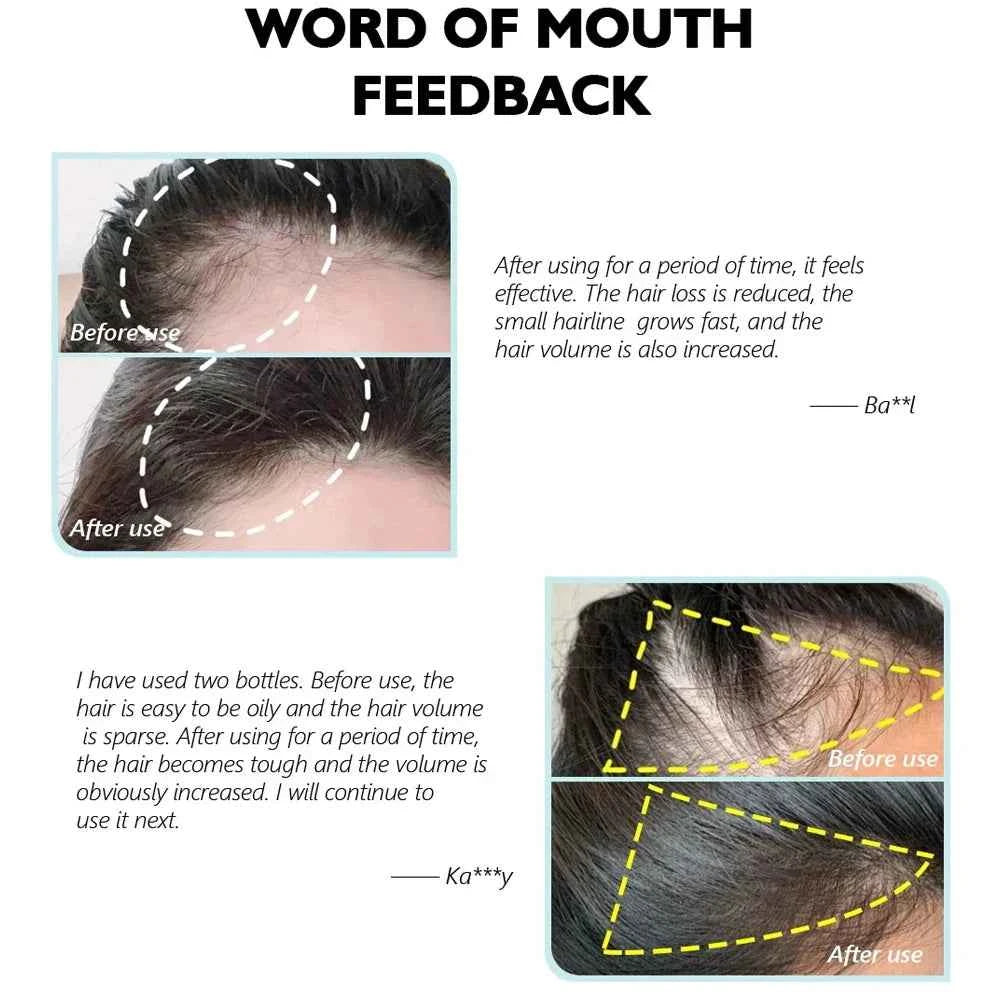 Fast Ginger Hair Growth Cream Anti Hair Loss Baldness Repair Damaged Scalp Treatment Nourish Hair Root Care Products Women Men