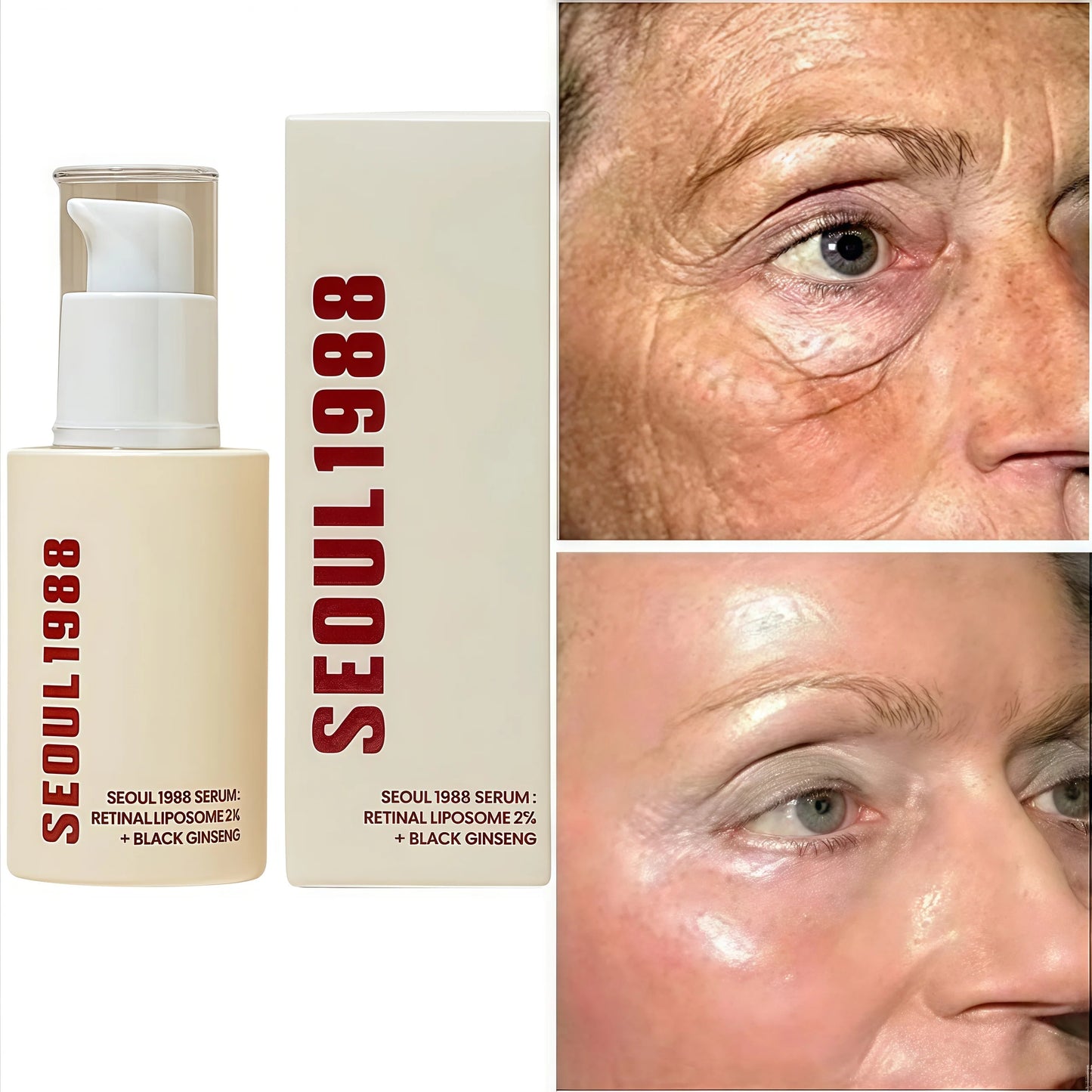 SEOUL 1988 Eye Cream Niacinamide 2% Retinal Acid Ginseng Serum Lighten Fine Lines Firming Pores Brightening Face Korean Skincare - AMULET RING STORE