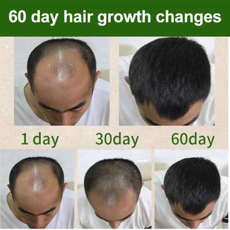 Fast Hair Growth Oil Africa Crazy Traction Alopecia Serum Anti Hair Break Thicken Hair Loss Treatment Spray For Man Women 60ML