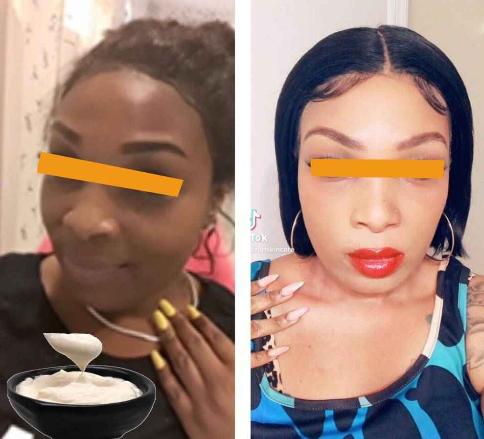 Skin Whitening Kojic Acid,Arbutin,Niacinamide,Hylauronic Acid, Dark Spot Serum Cream Dark Spot Remover for Face Whitening Cream