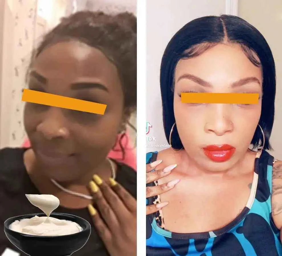 Skin Whitening Kojic Acid,Arbutin,Niacinamide,Hylauronic Acid, Dark Spot Serum Cream Dark Spot Remover for Face Whitening Cream