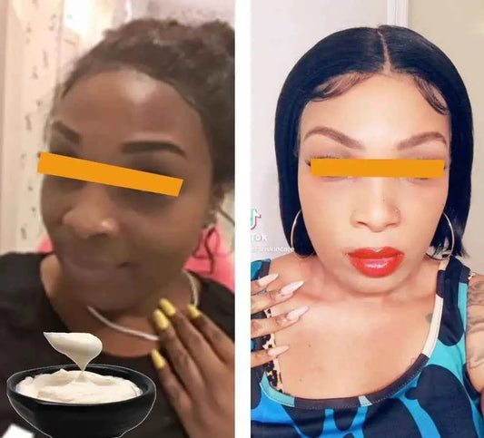 Skin Whitening Kojic Acid,Arbutin,Niacinamide,Hylauronic Acid, Dark Spot Serum Cream Dark Spot Remover for Face Whitening Cream