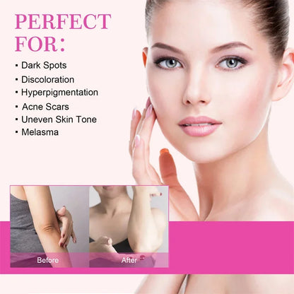 Brightening Cream For Intimate Parts Body Knees Remove Dull Pigments Brighten Serum Elbows Knuckles Lightening Skin Care Product - AMULET RING STORE