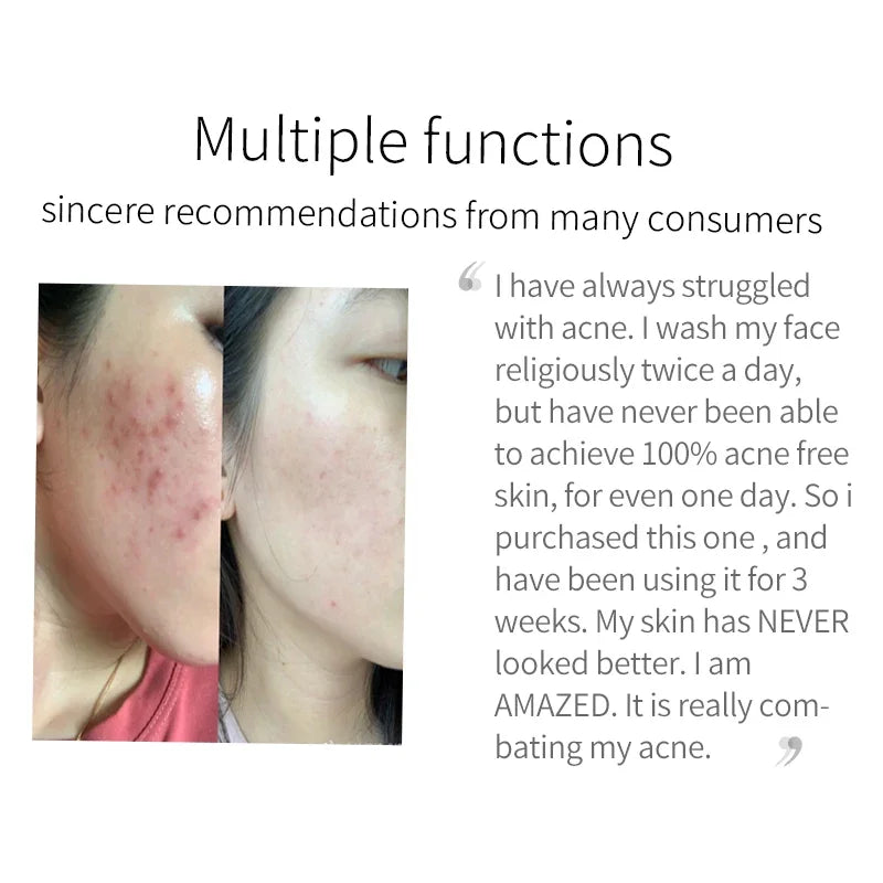 Turmeric lemon Skin Care products Acne Dark Spot Remover Whitening Brighten Facial Serum Face Cream Cleanser Serum Oil Cosmetics