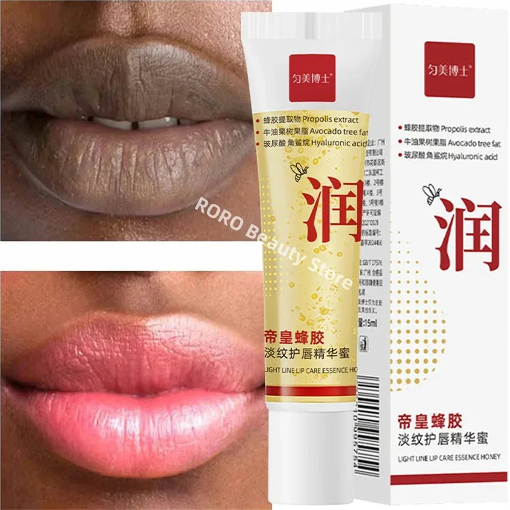 Remove Dark Lip Balm Fast Lightening Pink Lip Exfoliating Fade Lip Line Dead Skin Moisturizer Korean Care Products Beauty Health - AMULET RING STORE