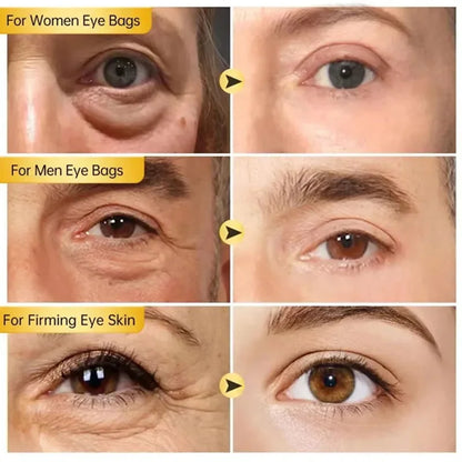 Instant Eye Bag Remove Eye Cream Anti Fat Particles Dark Circles Puffiness Fade Fine Lines Lift Brighten Korean Beauty Eye Care - AMULET RING STORE