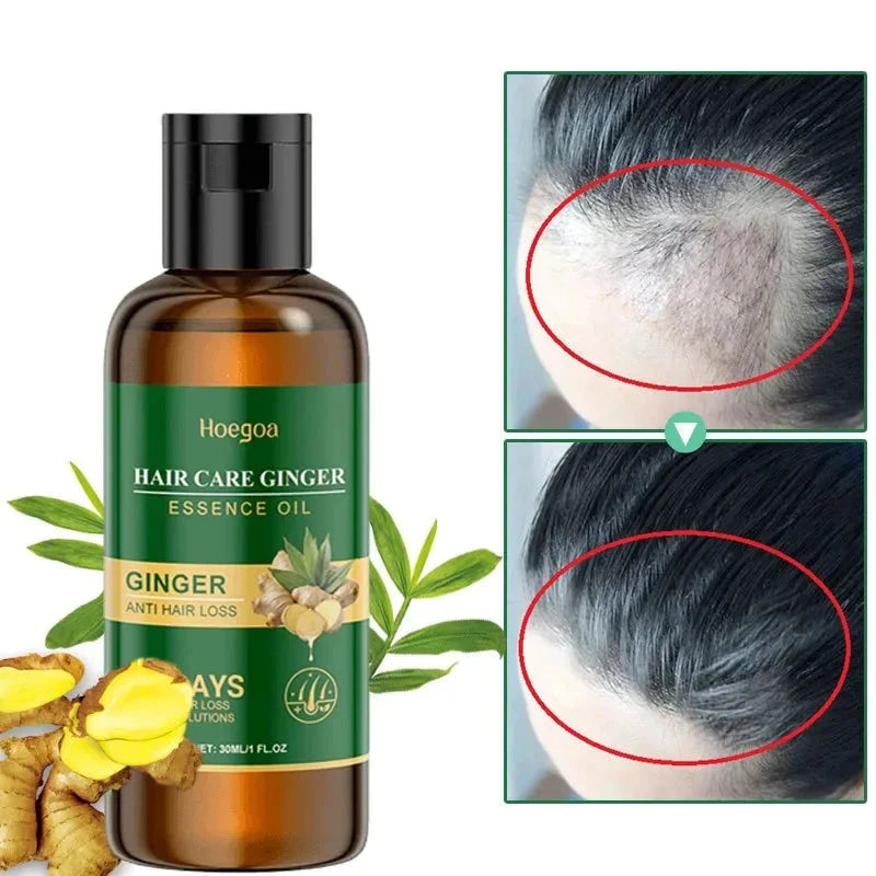 Ginger Hair Growth Serum 7 Days Fast Regrowth Essential Oil Anti Hair loss Prevent Hair Dry Frizzy Damaged Repair Care Products