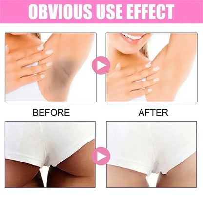 Whitening Cream Private Parts Underarm Bleaching Serum Whiten Butt Knee Brighten Inner Thigh Intimate Parts Dark Remove Melanin