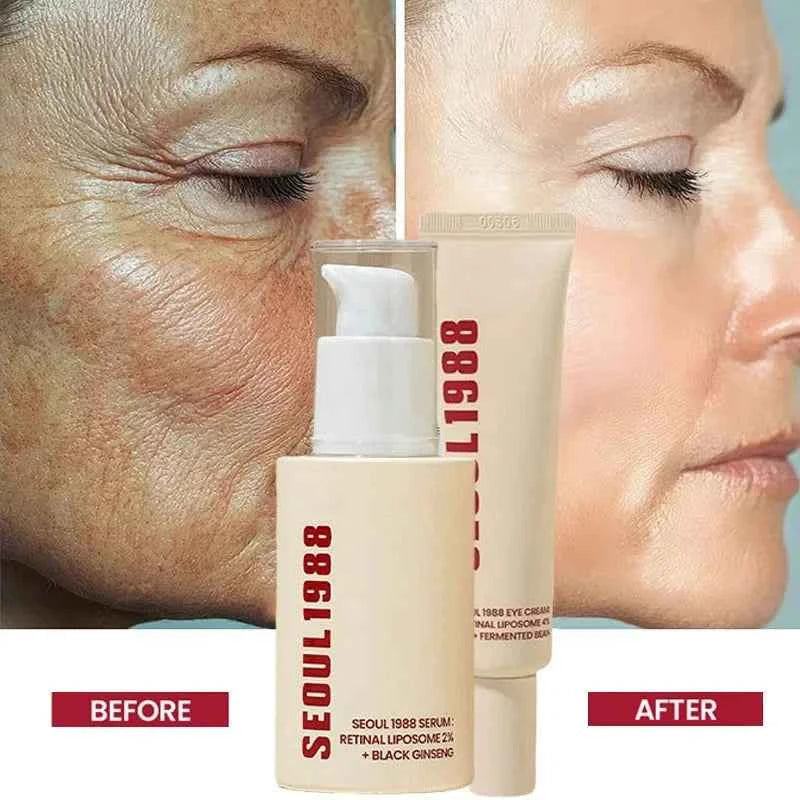 SEOUL 1988 Vitamin C Wrinkle Care 4% Retinol Ginseng Face Serum Firm Fine Lines Eye Cream Hydrating Moisturizing Brightening Set