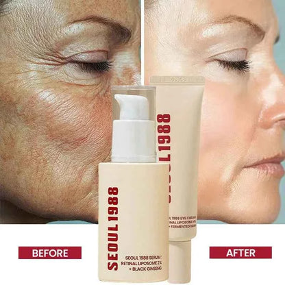 SEOUL 1988 Vitamin C Wrinkle Care 4% Retinol Ginseng Face Serum Firm Fine Lines Eye Cream Hydrating Moisturizing Brightening Set