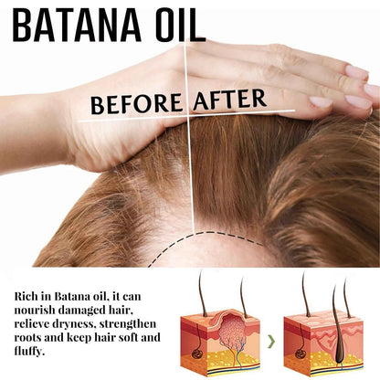 Fast Hair Growth Set Batana Oil Traction Alopecia Hair Mask Anti Break Loss Hair Growth Oil Baldness Treatment Hair Health Care
