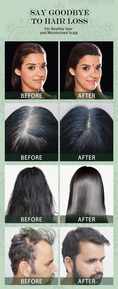 Sevich India Herbal Hair Growth Oil And Scalp Massager Comb Tool Set Ayurvedic Adivasi Fast Regrowth Thicken Serum Hair Growing - AMULET RING STORE