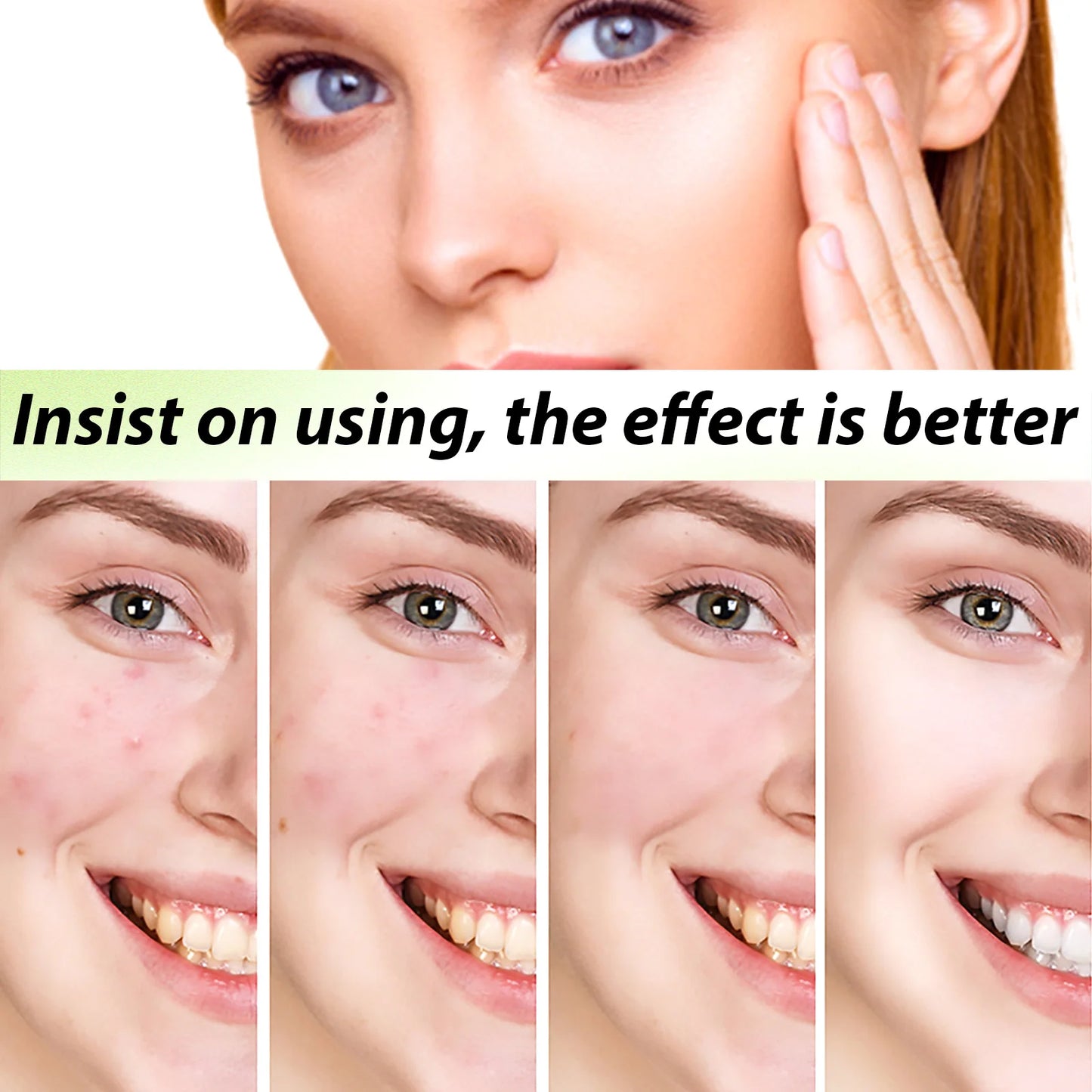 Acne Face Cream Pimple Treatment Oil Control Repair Redness Remove Blackhead Smooth Hydrating Moisturizing Pore Shrinking Serum - AMULET RING STORE