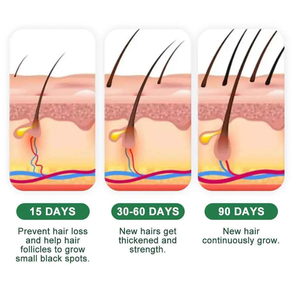 Fast Ginger Hair Growth Cream Anti Hair Loss Baldness Repair Damaged Scalp Treatment Nourish Hair Root Care Products Women Men