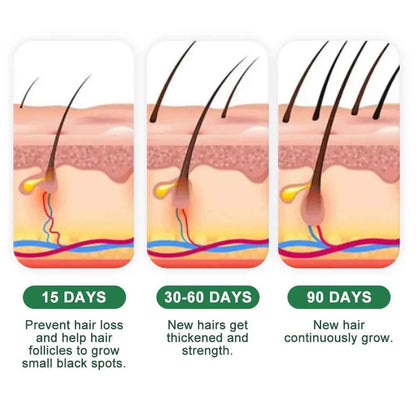 Fast Ginger Hair Growth Cream Anti Hair Loss Baldness Repair Damaged Scalp Treatment Nourish Hair Root Care Products Women Men