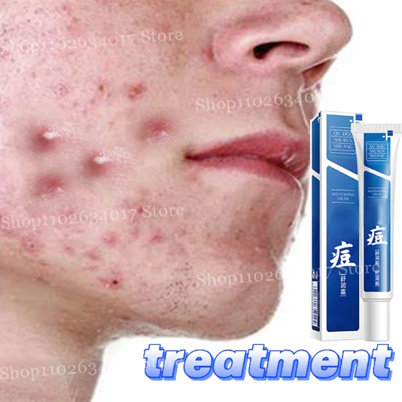 Pore Shrinking Cream Acne Pit Repair Products for Men and Women Remove acne mark scars Large pore anti-inflammatory smooth skin - AMULET RING STORE