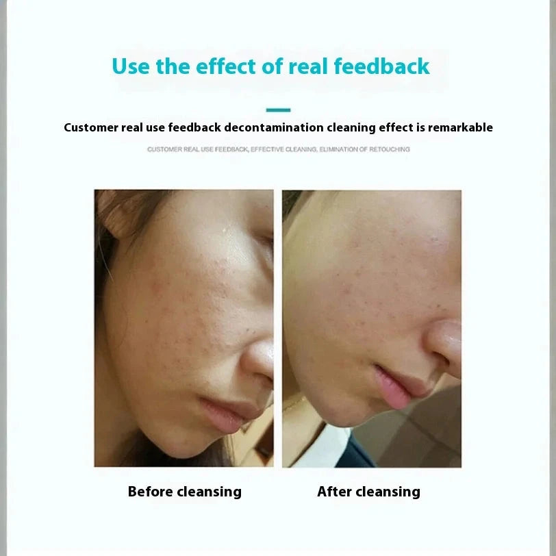 Portable Handheld Electric Silicone Facial Brush Facial Cleanser Pore Cleaning Massage Ultrasonic Facial Cleanser