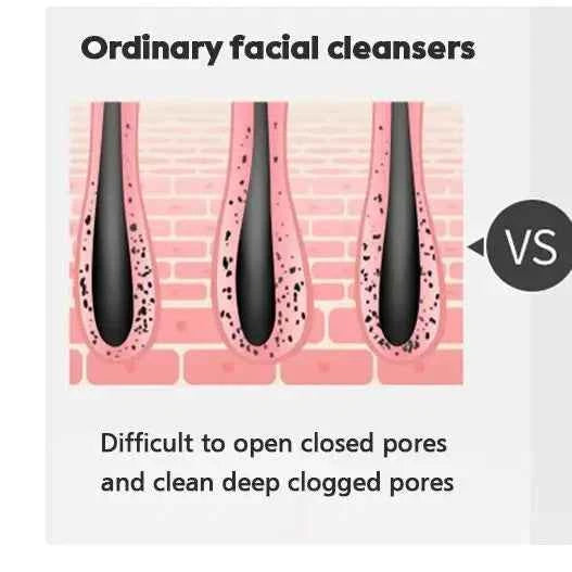 Electric Facial Cleanser Battery Powered Waterproof Vibrating Face Cleaning Brush 2 Speed Face Deep Washing Massaging Device