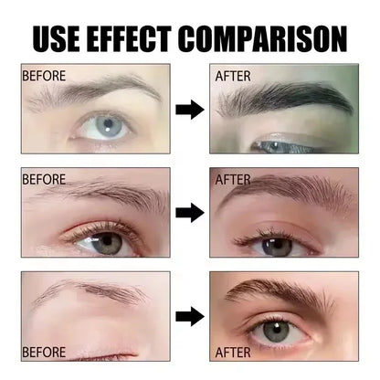 Fast Eyebrow Growth Serum Eyelash Hair Growth Anti Hairs Loss Product Prevent Baldness Fuller Thicker Lengthening Eyebrow Makeup - AMULET RING STORE