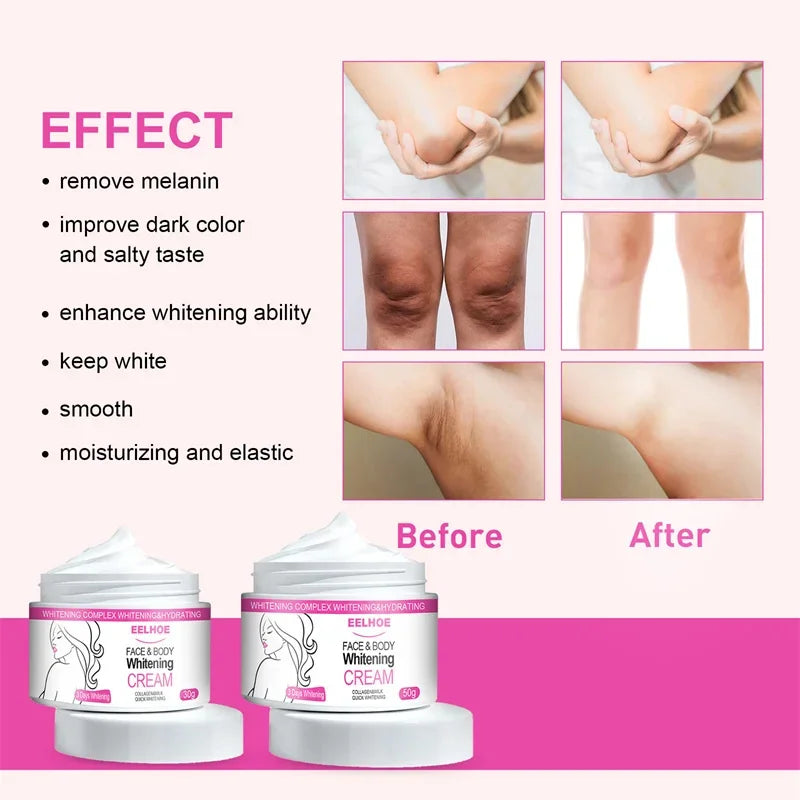 Brightening Cream For Intimate Parts Body Knees Remove Dull Pigments Brighten Serum Elbows Knuckles Lightening Skin Care Product - AMULET RING STORE