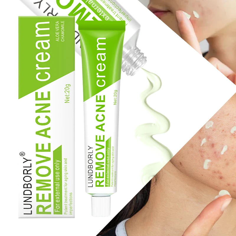 LUNDBORLY Acne Care Cream with Natural Herbal Extracts Helps Soothe Skin Improve Skin Texture and Keep Skin Smooth and Radiant - AMULET RING STORE