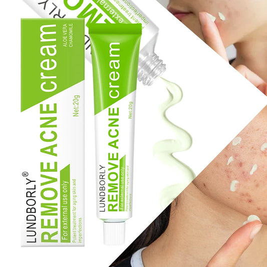 LUNDBORLY Acne Care Cream with Natural Herbal Extracts Helps Soothe Skin Improve Skin Texture and Keep Skin Smooth and Radiant - AMULET RING STORE