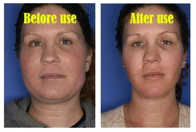 Effective V-Shape Face Slimming Lifting Facial Cream Lift Up V Double Chin Cheek Slimming Firming Anti Wrinkle Beauty Skin Care - AMULET RING STORE