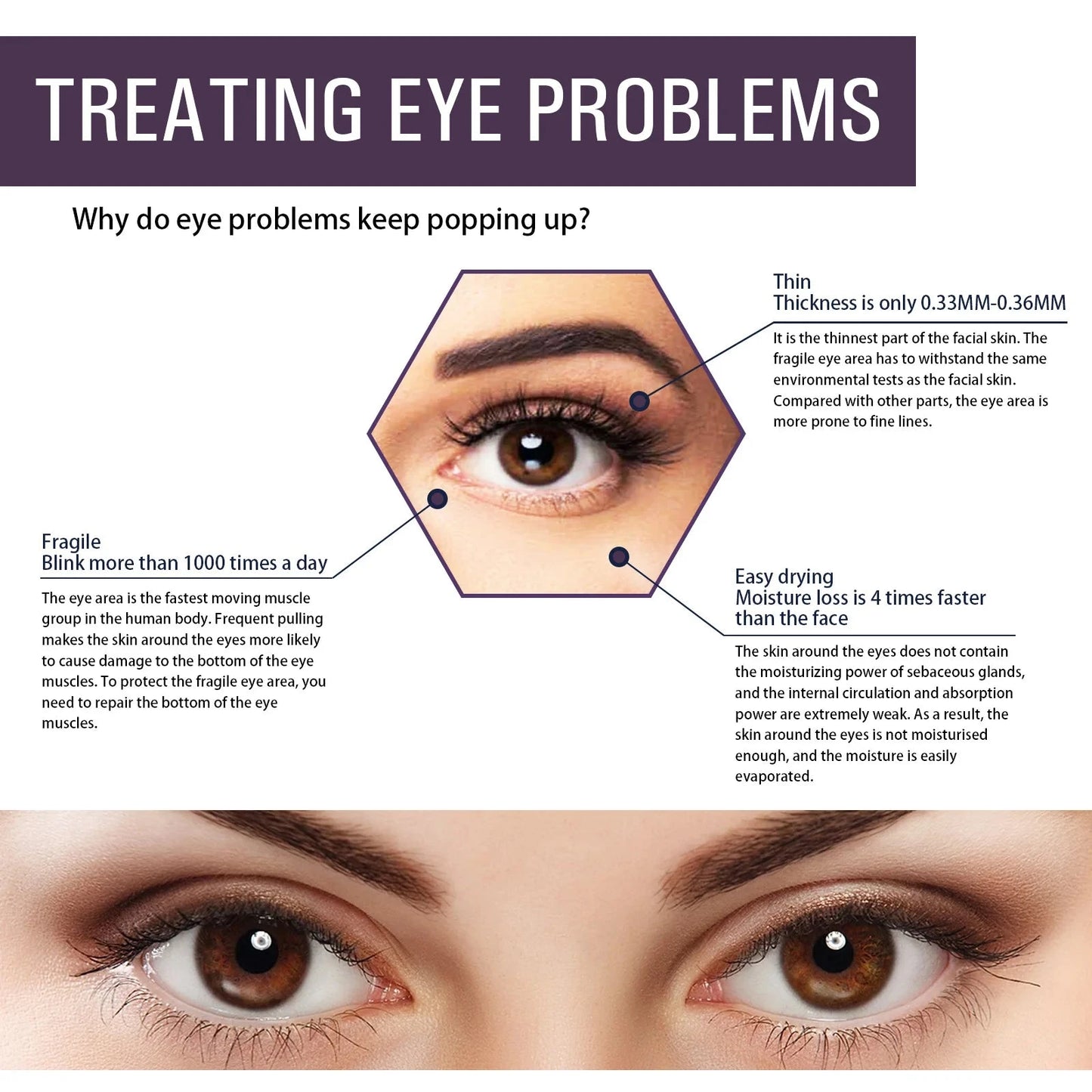 Electric Massage Eye Cream Anti Wrinkle Eye Patches Moisturizing Improve Bags Nourish Area Against Puffiness Bags Hydrate - AMULET RING STORE