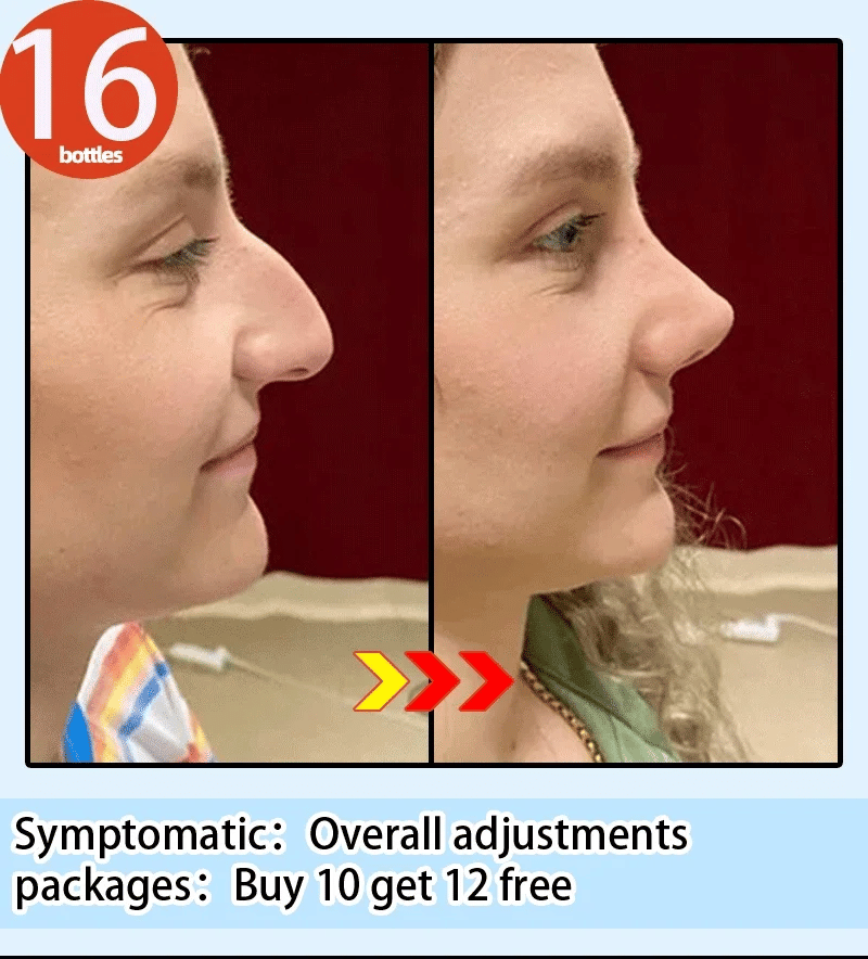 Nose Massage Essential Oil Up Heighten Rhinoplasty Firming For Moisturizing Nose Serum Reshape Natural Face Beauty Care Products - AMULET RING STORE