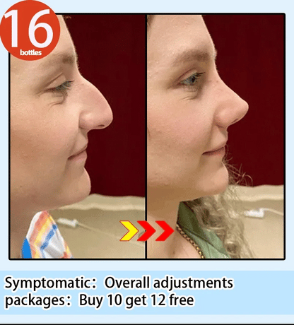 Nose Massage Essential Oil Up Heighten Rhinoplasty Firming For Moisturizing Nose Serum Reshape Natural Face Beauty Care Products - AMULET RING STORE