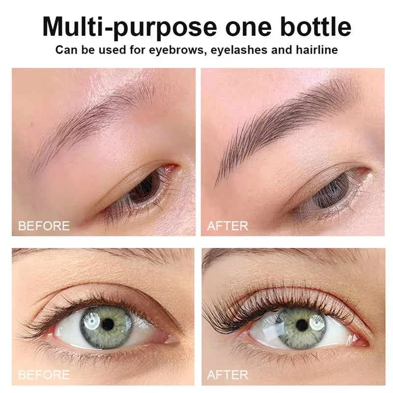 Eyebrow growth serum fast growing eyelash prevent hair loss damaged treatment thick dense eyes makeup care products - AMULET RING STORE