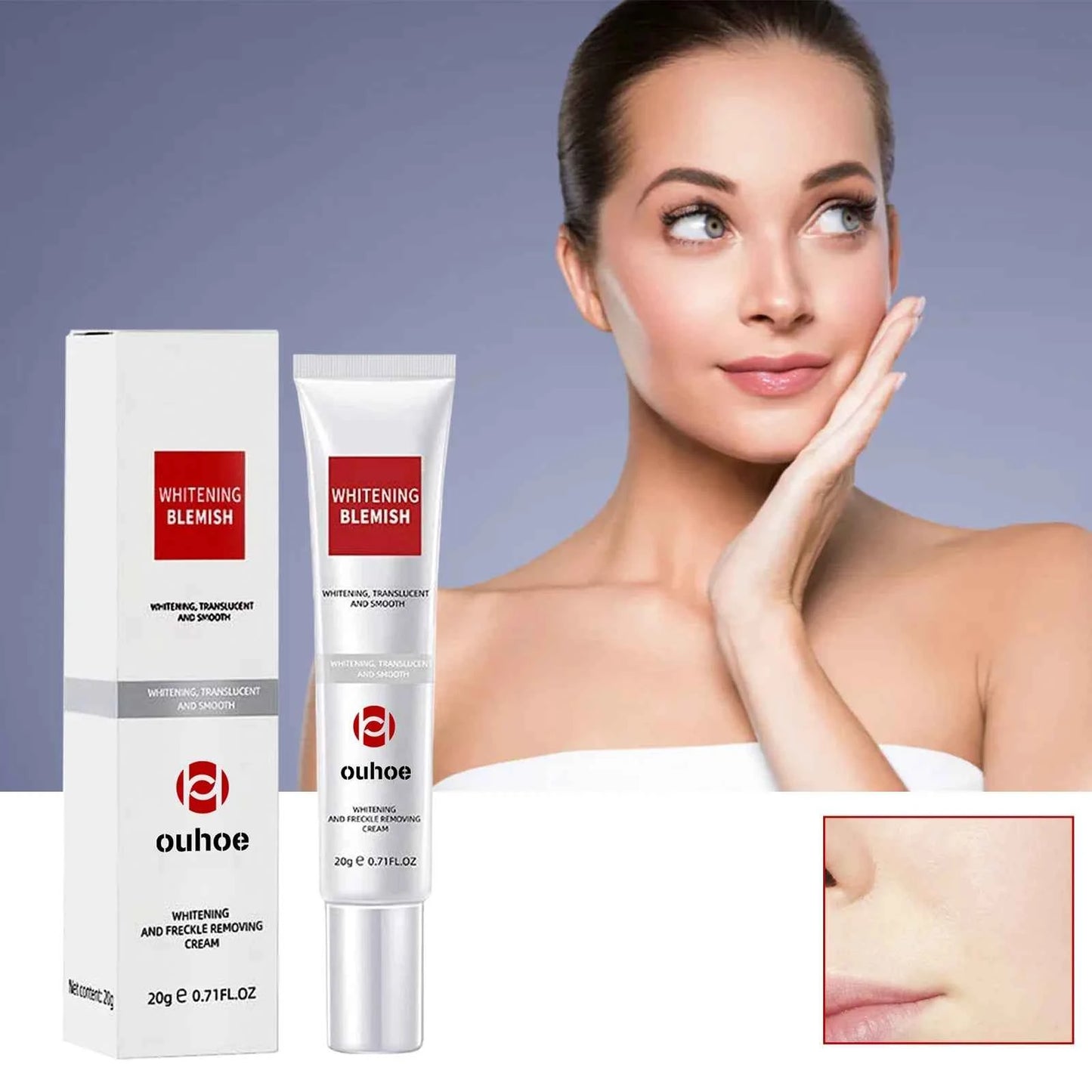 Ouhoe 20g Niacinamide Dark Spots Remover Cream Lighten Melanin Improve Dullness Brighten Skin Tone Smooth Face Repairing Cream