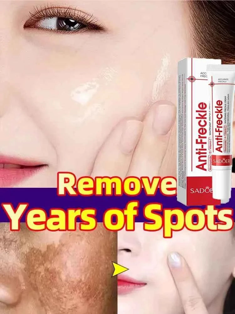 Effective Whitening Freckles Face Cream Dark Spot Corrector Remove Melasma Fade Melanin Pigmentation Brighten Skin Care Products