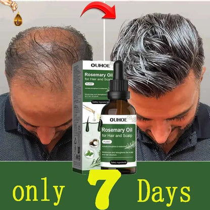 Rosemary Hair Growth Oil Anti Hairs Loss Treatment Mint Hair Strengthening Oil Nourishing Roots Regrowth Hair For Men Women 50ml