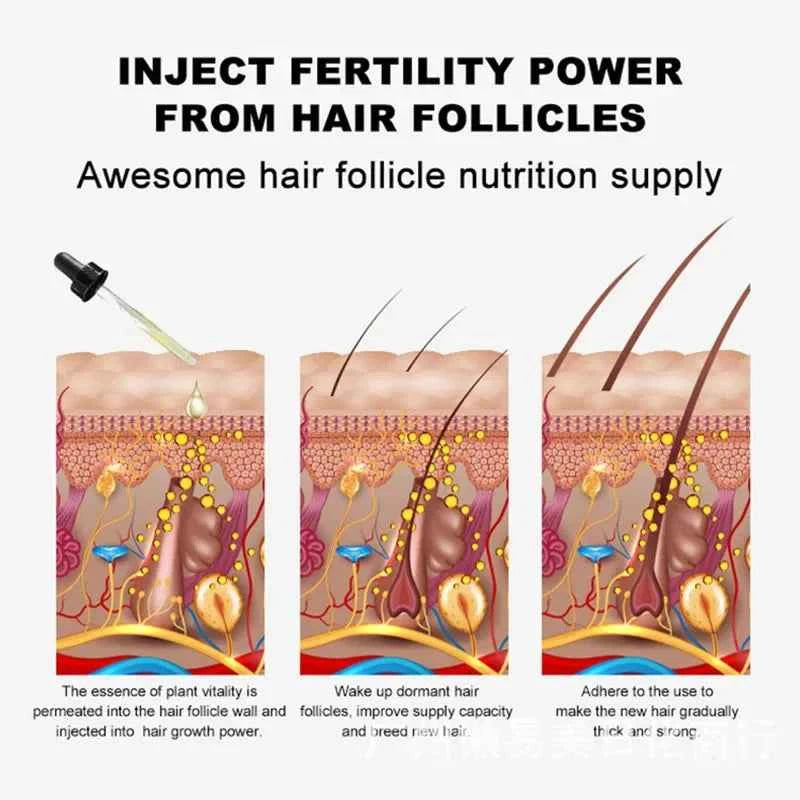 Ginger Hair Growth Serum 7 Days Fast Regrowth Essential Oil Anti Hair loss Prevent Hair Dry Frizzy Damaged Repair Care Products