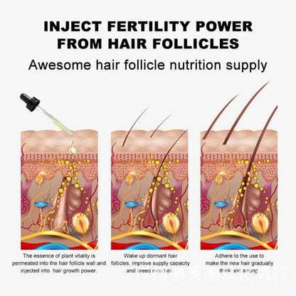 Ginger Hair Growth Serum 7 Days Fast Regrowth Essential Oil Anti Hair loss Prevent Hair Dry Frizzy Damaged Repair Care Products