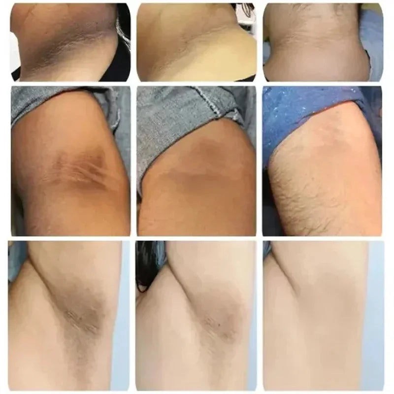 Brightening Cream For Intimate Parts Body Knees Remove Dull Pigments Brighten Serum Elbows Knuckles Lightening Skin Care Product - AMULET RING STORE