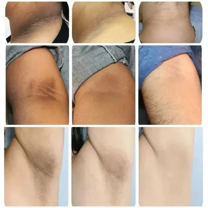 Brightening Cream For Intimate Parts Body Knees Remove Dull Pigments Brighten Serum Elbows Knuckles Lightening Skin Care Product - AMULET RING STORE