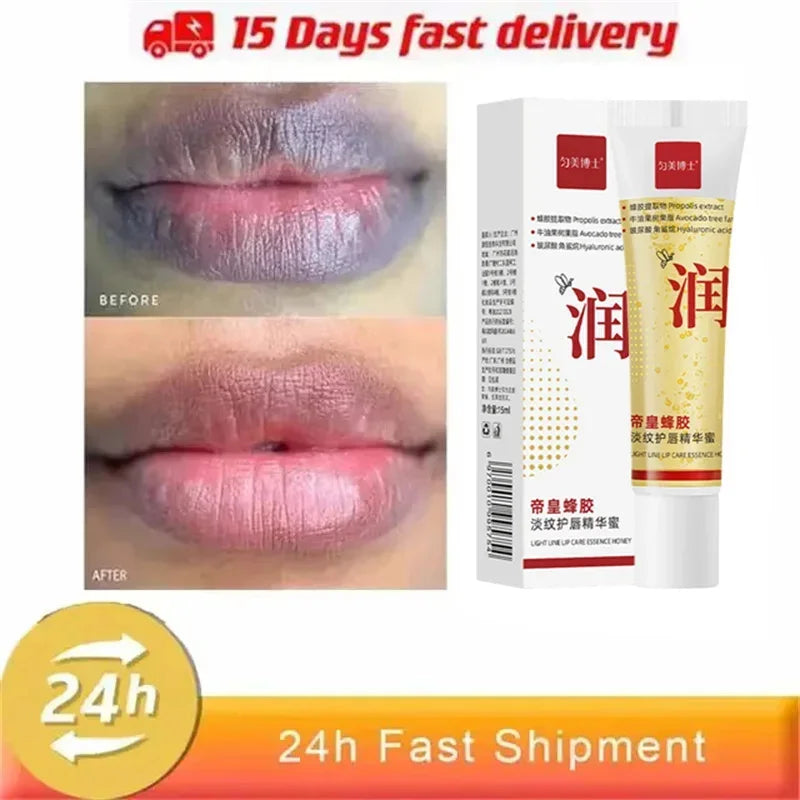 Remove Dark Lip Balm Fast Lightening Pink Lip Exfoliating Fade Lip Line Dead Skin Moisturizer Korean Care Products Beauty Health - AMULET RING STORE