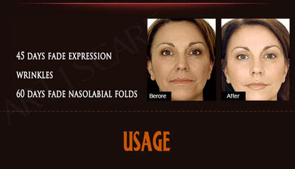 ARTISCARE Aging & Beauty Eyes Serum SET Anti Dark Circles Wrinkles Removal Coenzyme Q10 Six Peptides cream 3Pcs