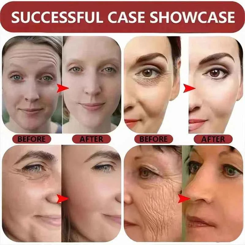 SEOUL 1988 Vitamin C Wrinkle Care 4% Retinol Ginseng Face Serum Firm Fine Lines Eye Cream Hydrating Moisturizing Brightening Set