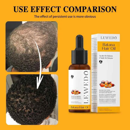 Batana Oil Hair Growth Scalp Strengthening Pure Hair Repair Hair Roots Damaged Hair Care Nourishing For Women Men Anti Hair Loss