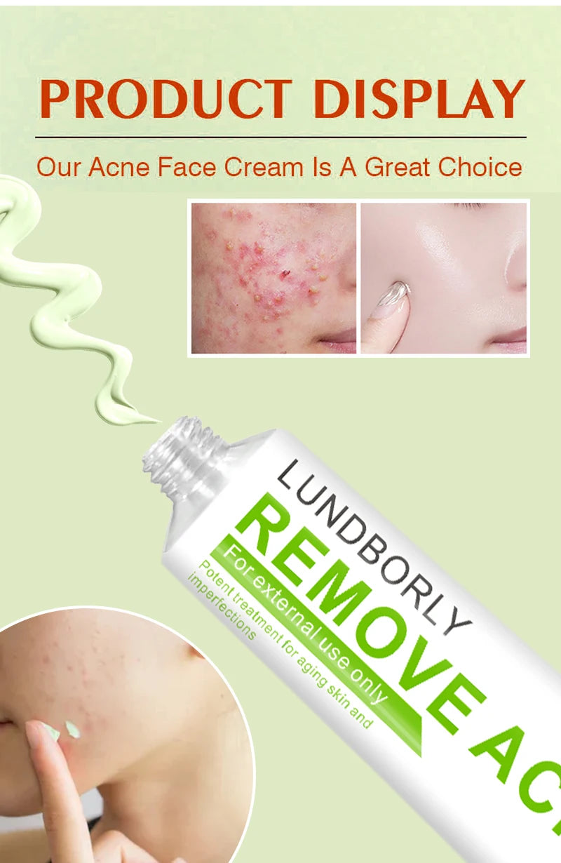 LUNDBORLY Acne Care Cream with Natural Herbal Extracts Helps Soothe Skin Improve Skin Texture and Keep Skin Smooth and Radiant - AMULET RING STORE
