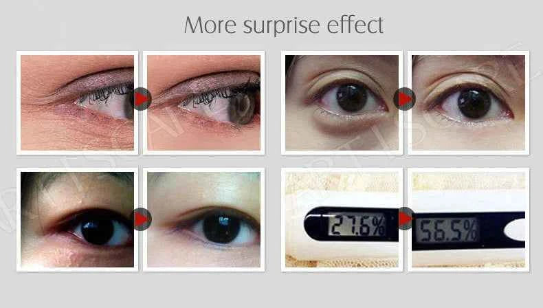 ARTISCARE Aging & Beauty Eyes Serum SET Anti Dark Circles Wrinkles Removal Coenzyme Q10 Six Peptides cream 3Pcs