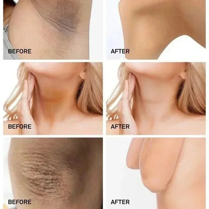 Whitening Cream Private Parts Underarm Bleaching Serum Whiten Butt Knee Brighten Inner Thigh Intimate Parts Dark Remove Melanin