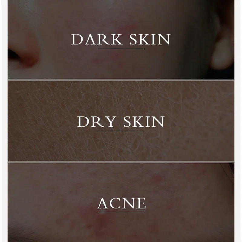 Turmeric lemon Skin Care products Acne Dark Spot Remover Whitening Brighten Facial Serum Face Cream Cleanser Serum Oil Cosmetics