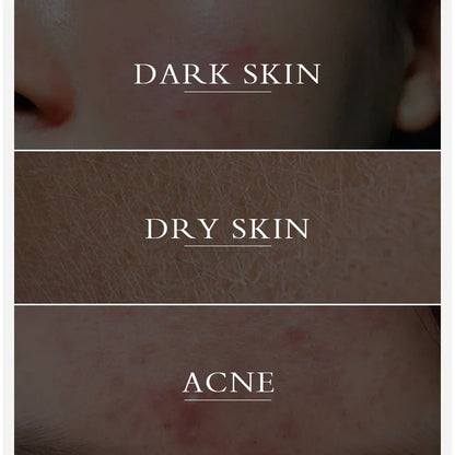 Turmeric lemon Skin Care products Acne Dark Spot Remover Whitening Brighten Facial Serum Face Cream Cleanser Serum Oil Cosmetics